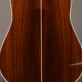 Martin D-45 Adirondack Custom Shop (2014) Detailphoto 4